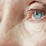 qırışların yaranmasının sirri