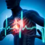 "Səssiz infarkt", İnfarkt