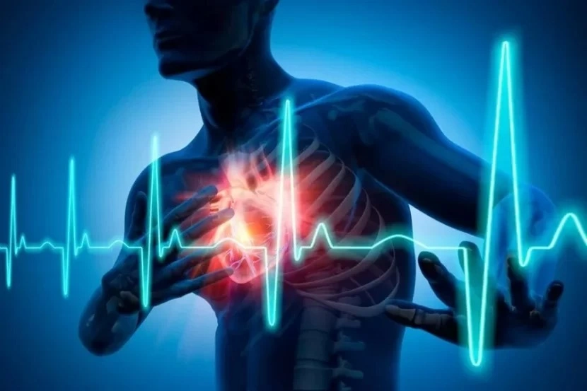 "Səssiz infarkt", İnfarkt